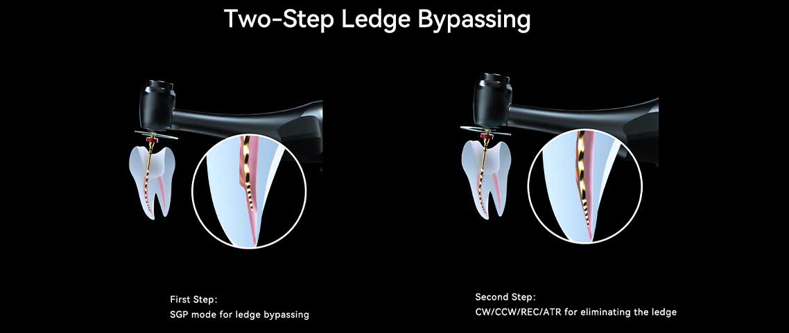 عبور از لِجبا اپکس روتاری 812 MT (Ledge Bypassing) در دو مرحله