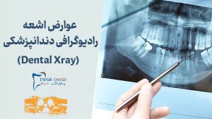 عوارض اشعه رادیوگرافی دندانپزشکی چیست
