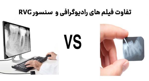 تفاوت سنسور RVG و فیلم های رادیوگرافی
