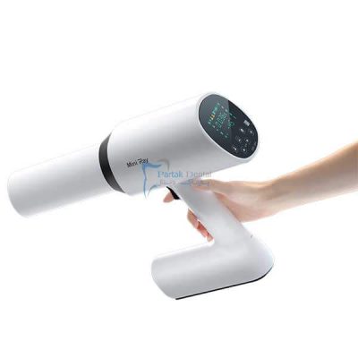 قیمت رادیوگرافی وودپیکر Mini Ray