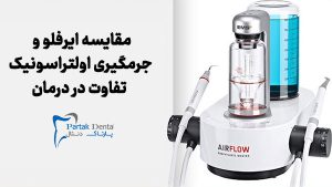 مقایسه ایرفلو با جرمگیری اولتراسونیک