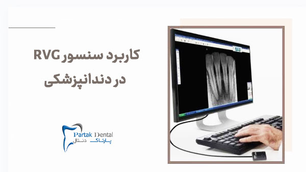 کاربرد سنسور RVG در دندانپزشکی